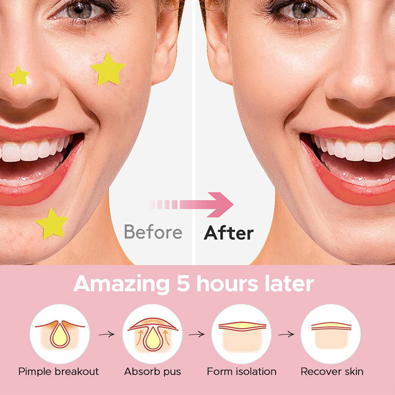 600Pcs/set Star Pimple Patch A - Beauty With Makeup recension och pris